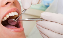 dental boutique Costa Rica Dental Treatment